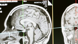 More Evidence That Radiology is Not the Source of Medicare Spending Increases